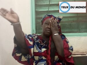 Mujer tapándose un ojo Mujer tapándose un ojo